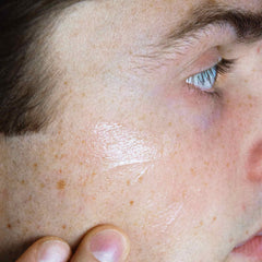 Clarifying Face Gel for Acne-prone Skin BAK Skincare Danmark